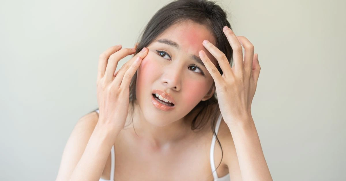 Close-up of an itching rash caused by allergic dermatitis, highlighting the need for a professional diagnosis.