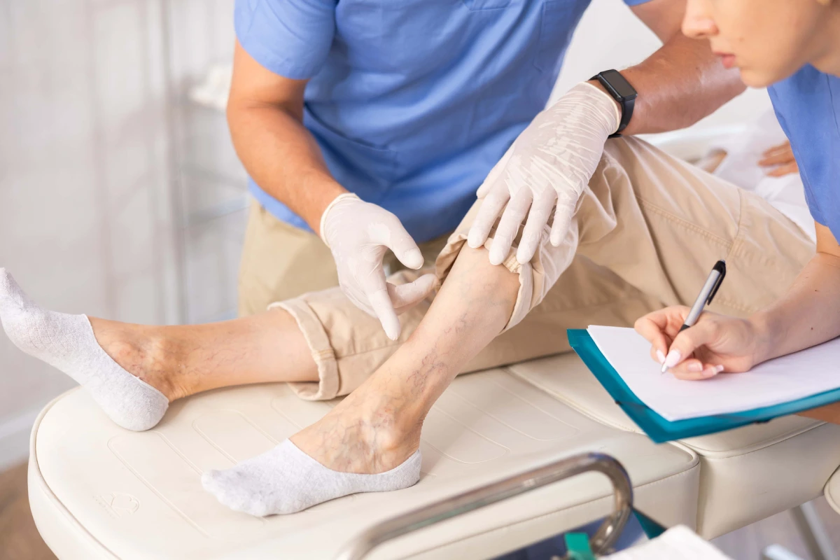 Medical professional examining spider veins before vein reduction therapy in Corpus Christi, TX.