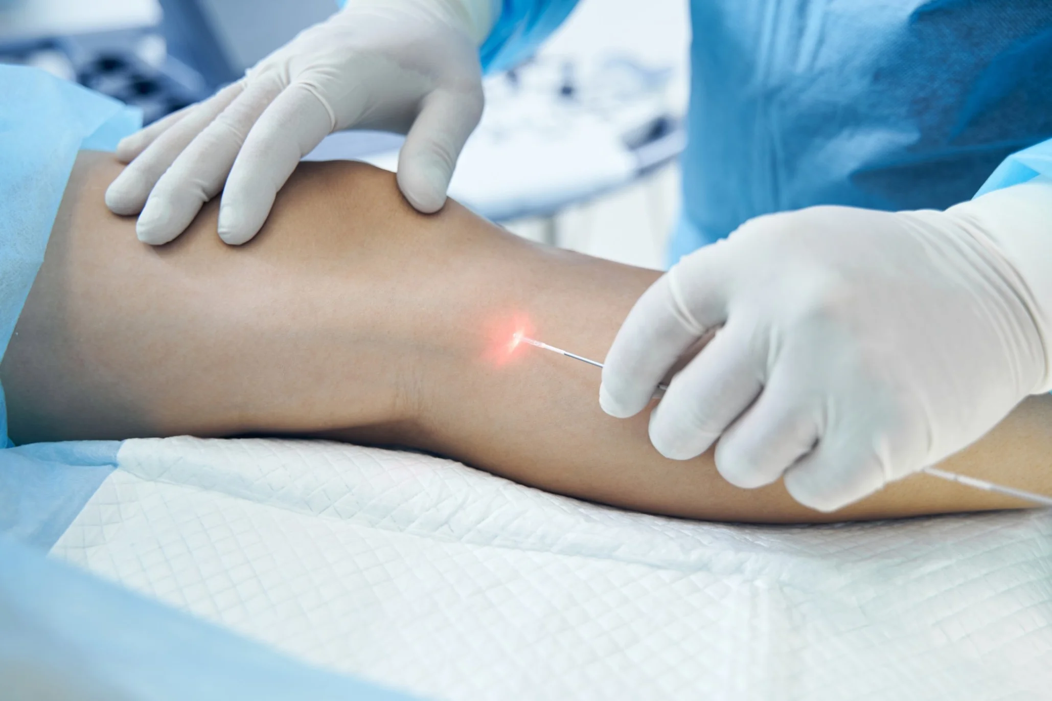 Endovenous Laser and Radio Frequency services Texas Vein and Vascular in Corpus Christi TX